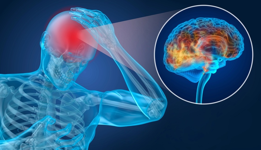 image of man holding head and showing xray showing tbi after a car accident